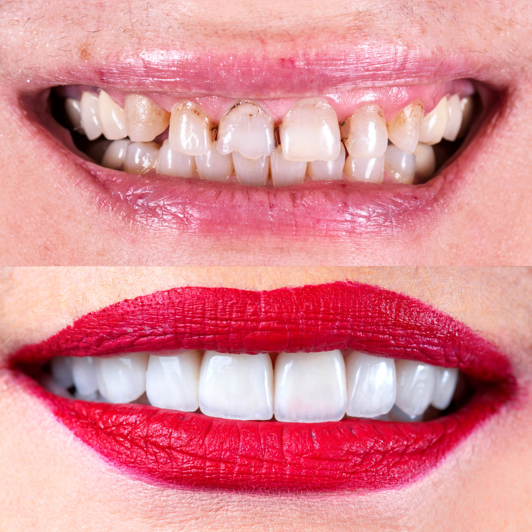 https://ikonclinic.com/wp-content/uploads/2025/08/3.png